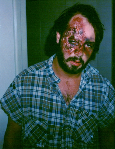 Lars Wyka Key Makeup - Burn / Crash victim ©1997